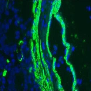 anti-Actin, alpha 2, Smooth Muscle, Aorta (ACTA2) antibody avatar