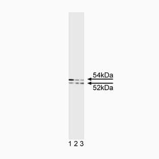 anti-Cytokeratin 5/8 antibody avatar