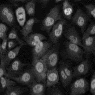 anti-Transportin (N-Term) antibody