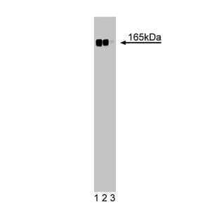 anti-Desmoglein (AA 705-1029) antibody