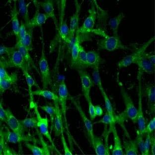 anti-Clathrin (AA 4-171), (Heavy Chain) antibody avatar