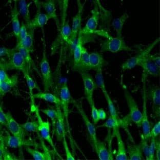 anti-Clathrin (AA 4-171), (Heavy Chain) antibody avatar