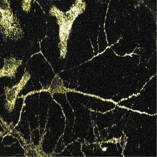 anti-Adaptin alpha (AA 38-215) antibody avatar