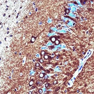 anti-PP2A Catalytic alpha (AA 153-309) antibody avatar