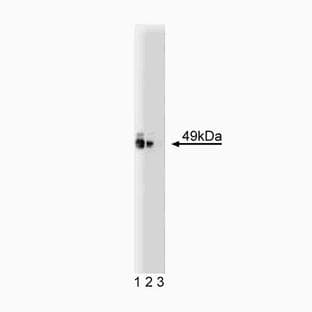 anti-PKA RI alpha (AA 1-381) antibody avatar