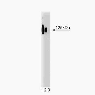 anti-K + Channel alpha (AA 995-1113) antibody