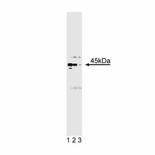 anti-Casein Kinase II alpha /alpha (AA 1-123) antibody avatar