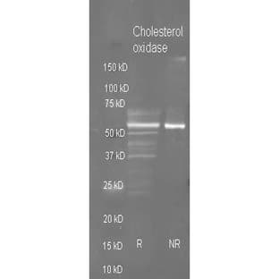 anti-Cholesterol Oxidase (choS) antibody (HRP) avatar