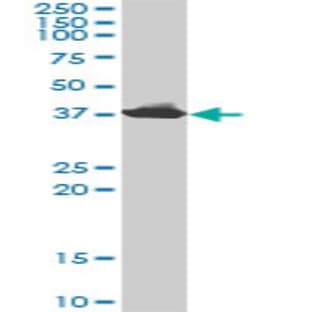 anti-Adenosine Deaminase (ADA) (AA 1-364) antibody avatar