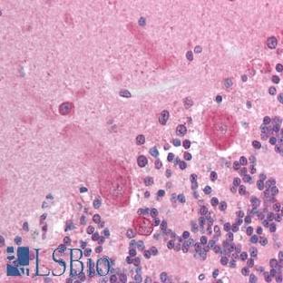 anti-V-Akt Murine Thymoma Viral Oncogene Homolog 3 (Protein Kinase B, Gamma) (AKT3) (AA 119-136) antibody