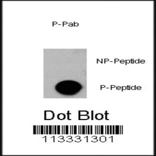 anti-V-Akt Murine Thymoma Viral Oncogene Homolog 3 (Protein Kinase B, Gamma) (AKT3) (pSer472) antibody