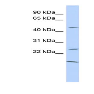 anti-BarH-Like Homeobox 2 (BARHL2) (Middle Region) antibody avatar