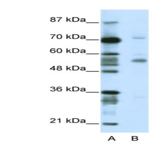 anti-Coronin, Actin Binding Protein, 1A (CORO1A) (N-Term) antibody
