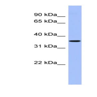 anti-Protein Phosphatase, Mg2+/Mn2+ Dependent, 1A (PPM1A) (Middle Region) antibody