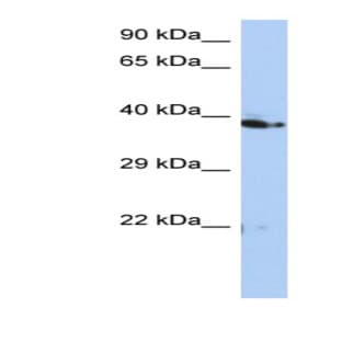 anti-CDK2-Associated, Cullin Domain 1 (CACUL1) (Middle Region) antibody avatar