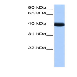 anti-Casein Kinase 1, gamma 3 (CSNK1G3) (Middle Region) antibody avatar