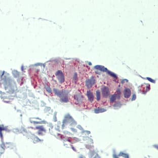 anti-Tankyrase, TRF1-Interacting Ankyrin-Related ADP-Ribose Polymerase (TNKS) (Middle Region) antibody