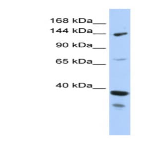 anti-DEAH (Asp-Glu-Ala-His) Box Polypeptide 37 (DHX37) (N-Term) antibody avatar