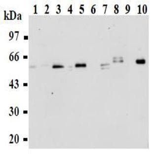 anti-Abl-Interactor 1 (ABI1) antibody avatar