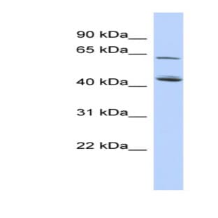 anti-Chromosome 5 Open Reading Frame 33 (C5orf33) (Middle Region) antibody avatar