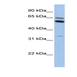 anti-Chromosome 2 Open Reading Frame 42 (C2orf42) (N-Term) antibody avatar