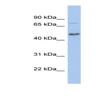 anti-Chromobox Homolog 8 (CBX8) (N-Term) antibody avatar