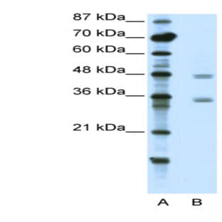 anti-Chromobox Homolog 8 (CBX8) (C-Term) antibody avatar