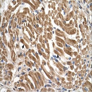 anti-Solute Carrier Family 17 (Acidic Sugar Transporter), Member 5 (SLC17A5) (N-Term) antibody avatar
