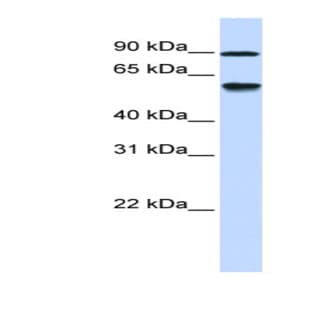 anti-Alcohol Dehydrogenase, Iron Containing, 1 (ADHFE1) (Middle Region) antibody avatar
