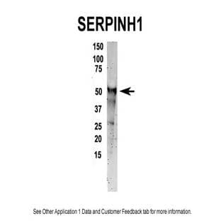 anti-serpin Peptidase Inhibitor, Clade H (Heat Shock Protein 47), Member 1, (Collagen Binding Protein 1) (SERPINH1) (C-Term) antibody avatar