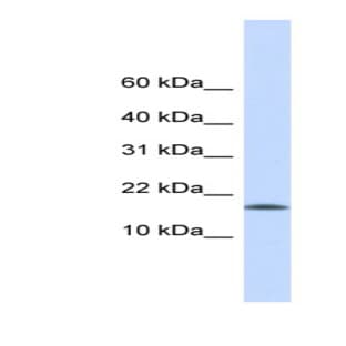 anti-Centromere Protein A (CENPA) (Middle Region) antibody avatar