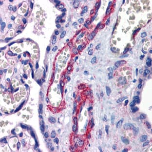 anti-Suppressor of Zeste 12 Homolog (Drosophila) (SUZ12) (Middle Region) antibody