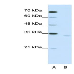 anti-Cytoplasmic Polyadenylation Element Binding Protein 2 (CPEB2) (Middle Region) antibody avatar