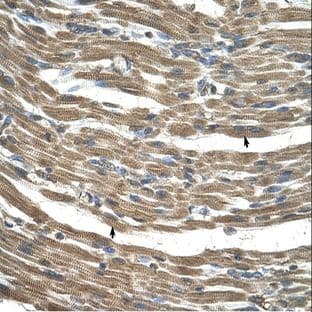 anti-Chromosome 21 Open Reading Frame 33 (C21orf33) (N-Term) antibody avatar