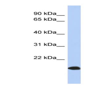 anti-ADP-Ribosylation Factor-Like 17B (ARL17) (Middle Region) antibody avatar