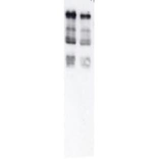 anti-Ubiquitin antibody