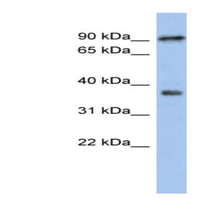 anti-Radial Spoke Head 10 Homolog B (Chlamydomonas) (RSPH10B) (Middle Region) antibody