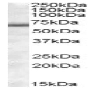 anti-Collagen, Type IV, alpha 3 (Goodpasture Antigen) Binding Protein (COL4A3BP) (Internal Region), (AA 396-411) antibody avatar