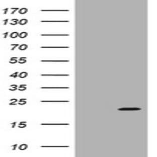 anti-Actin Related Protein 2/3 Complex, Subunit 5, 16kDa (ARPC5) antibody avatar