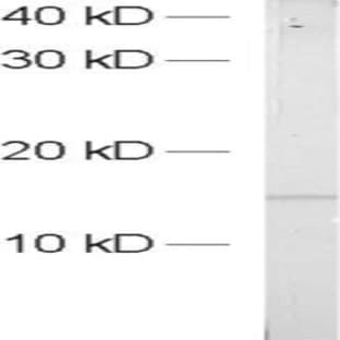 anti-Actin Related Protein 2/3 Complex, Subunit 5, 16kDa (ARPC5) (AA 19-24) antibody avatar