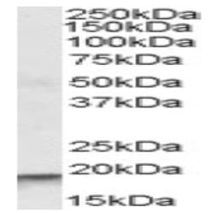 anti-Actin Related Protein 2/3 Complex, Subunit 4, 20kDa (ARPC4) (Internal Region), (Isoform A) antibody avatar