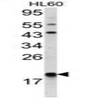 anti-Actin Related Protein 2/3 Complex, Subunit 3, 21kDa (ARPC3) (C-Term) antibody avatar