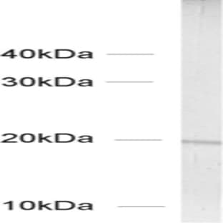 anti-Actin Related Protein 2/3 Complex, Subunit 3, 21kDa (ARPC3) (AA 109-120) antibody avatar