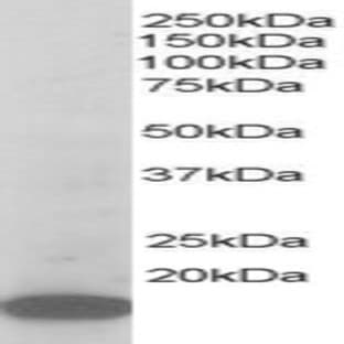 anti-Actin Related Protein 2/3 Complex, Subunit 3, 21kDa (ARPC3) (C-Term) antibody avatar