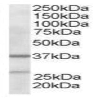 anti-Actin Related Protein 2/3 Complex, Subunit 1B, 41kDa (ARPC1B) (N-Term) antibody avatar