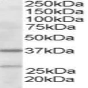 anti-Actin Related Protein 2/3 Complex, Subunit 1B, 41kDa (ARPC1B) (N-Term) antibody avatar