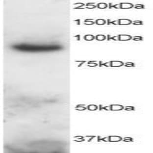 anti-ADAM Metallopeptidase Domain 8 (ADAM8) (C-Term) antibody avatar