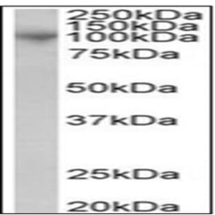 anti-A Disintegrin and Metallopeptidase Domain 8 (ADAM8) (C-Term) antibody avatar
