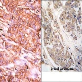 anti-CTD (Carboxy-terminal Domain, RNA Polymerase II, Polypeptide A) Small Phosphatase 2 (CTDSP2) (N-Term) antibody avatar
