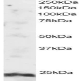 anti-ADP-Ribosylation Factor-Like 4A (ARL4A) (N-Term) antibody avatar